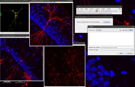 imagej documentation wiki.
